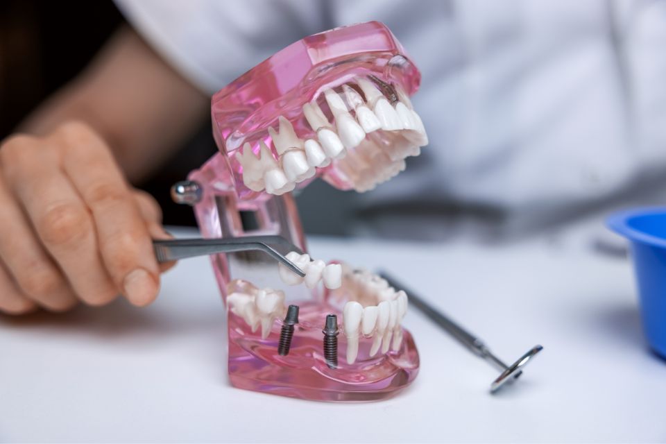植牙過程要多久？拆解4個植牙步驟，帶你從術前評估開始了解完整植牙療程